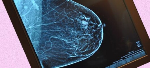 Kan radiografer tyde mammografi?